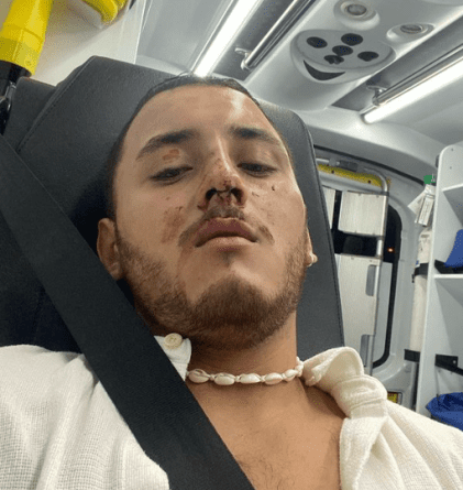 Denuncia por brutal agresión en la discoteca Copity de Alicante