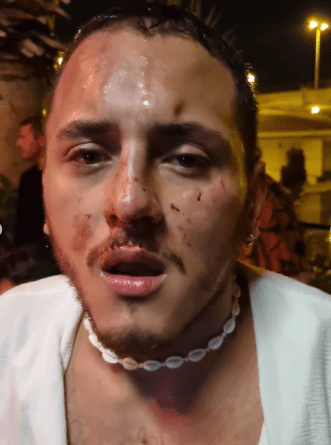 Denuncia por brutal agresión en la discoteca Copity