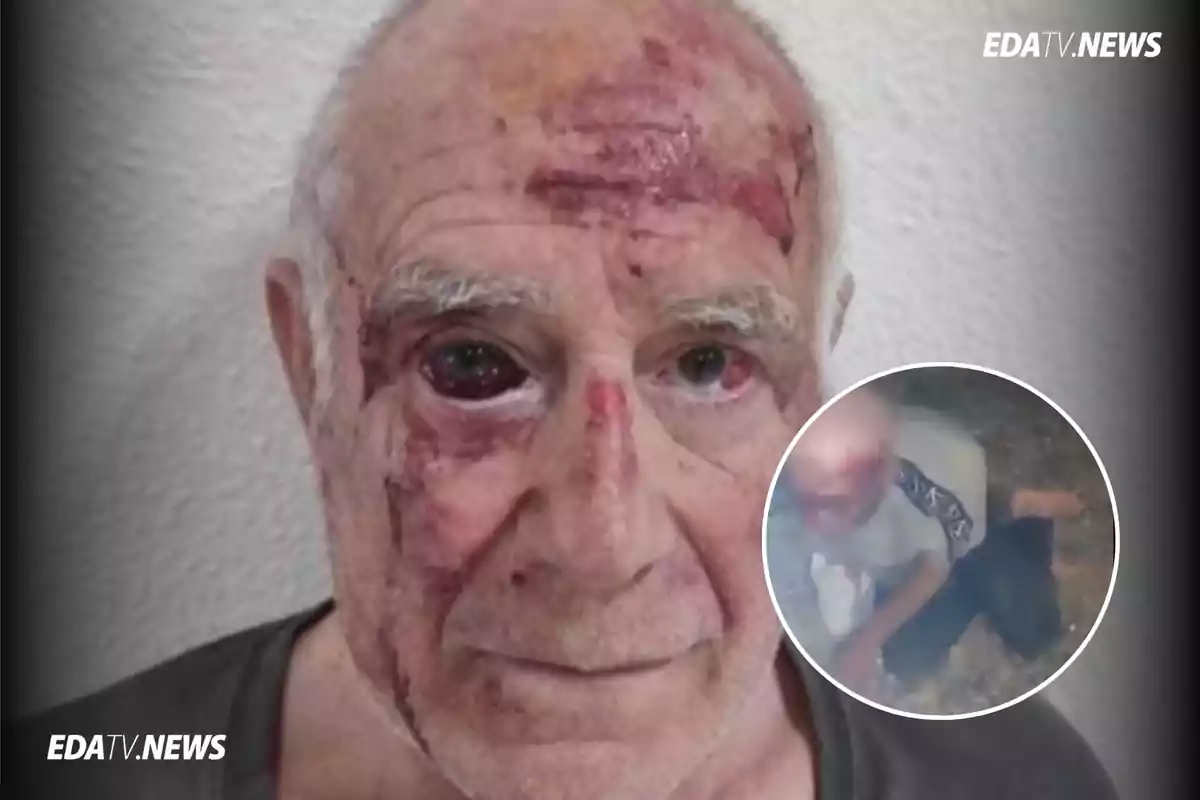 Brutal agresión a un anciano en Torre-Pacheco: indignación por el ataque de un grupo de jóvenes magrebíes