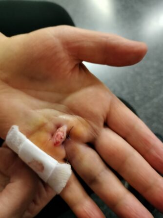 Una paciente de 72 años denuncia el mal trato recibido en el Hospital General de Elda