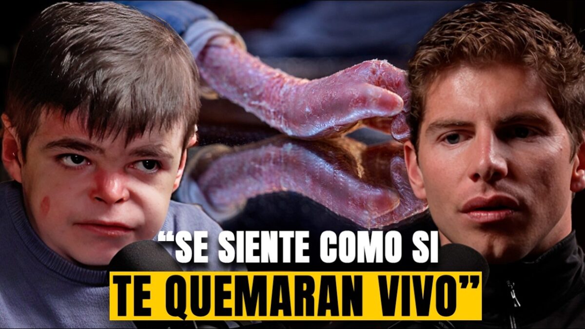 Un niño sevillano pone voz a la “piel de mariposa” y reclama en España el acceso a Vyjuvek, la primera terapia génica tópica aprobada en la UE